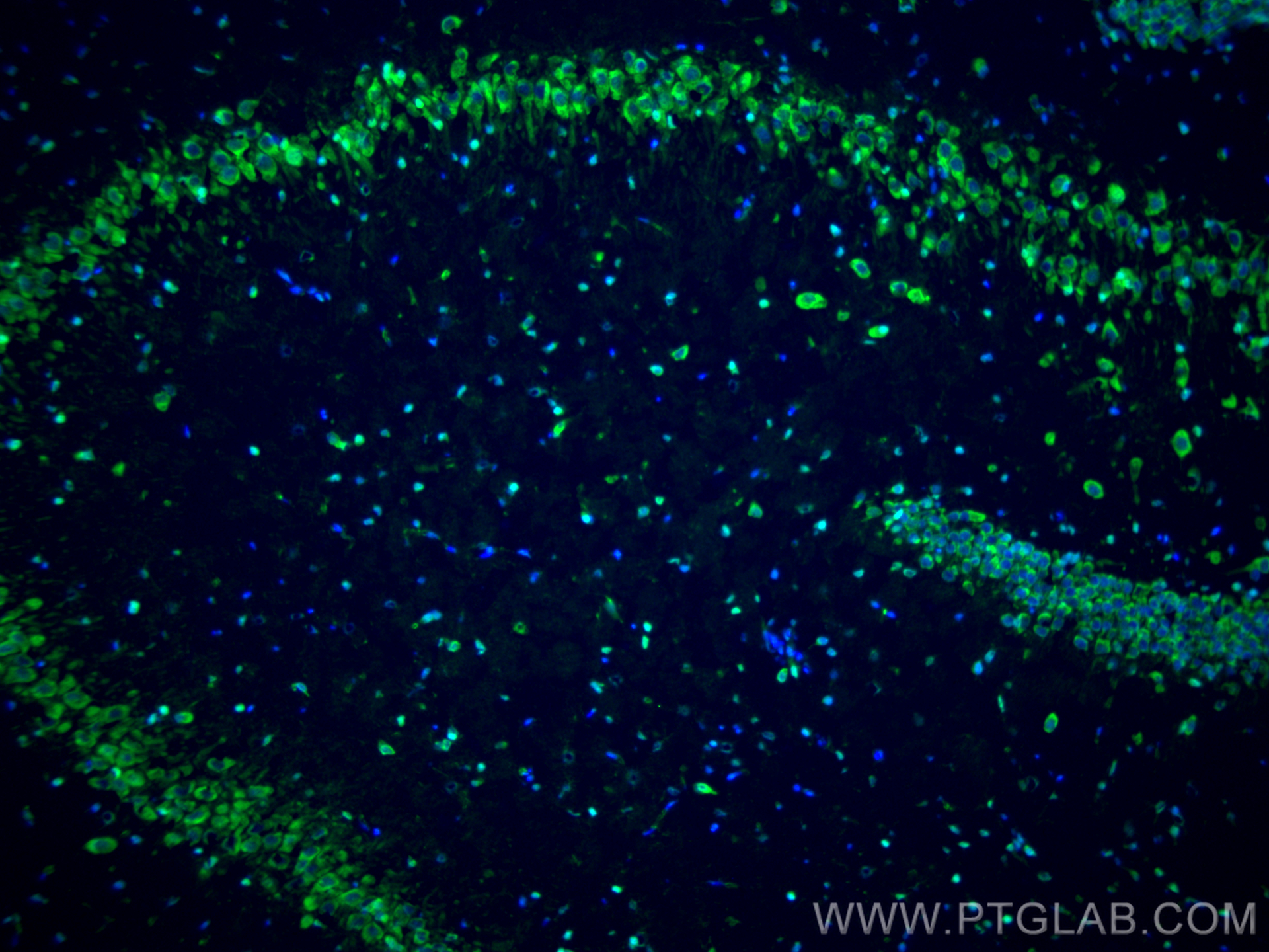 IF Staining of rat brain using 10777-1-AP