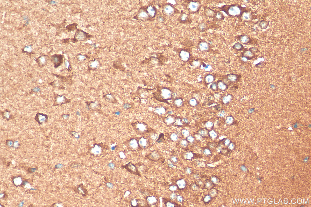 IHC staining of mouse brain using 10777-1-AP