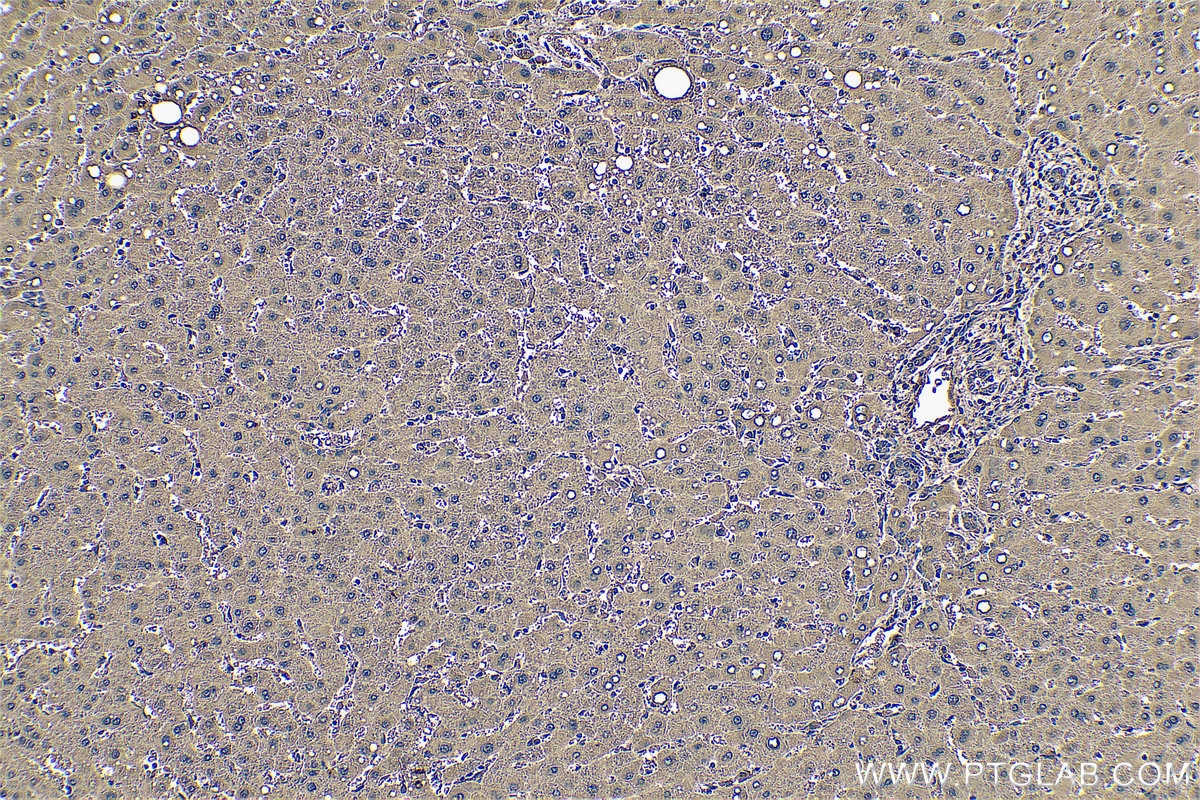 IHC staining of human liver using 14490-1-AP IHC staining of human liver using 14490-1-AP