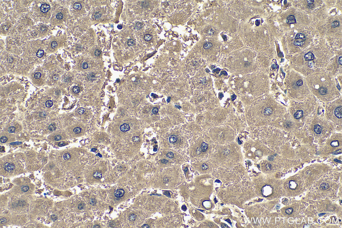 IHC staining of human liver using 14490-1-AP IHC staining of human liver using 14490-1-AP