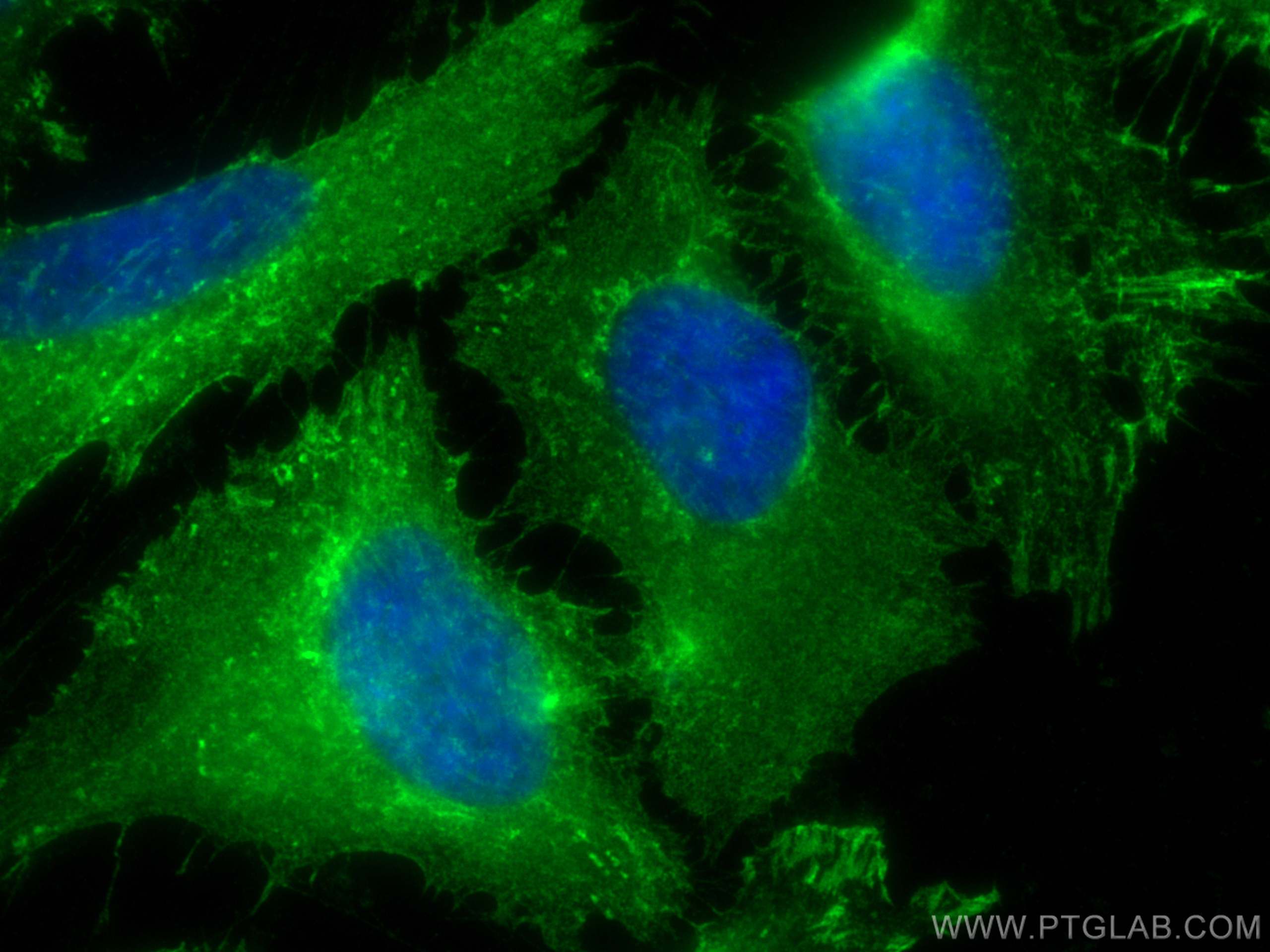 IF Staining of HeLa using 10260-1-AP