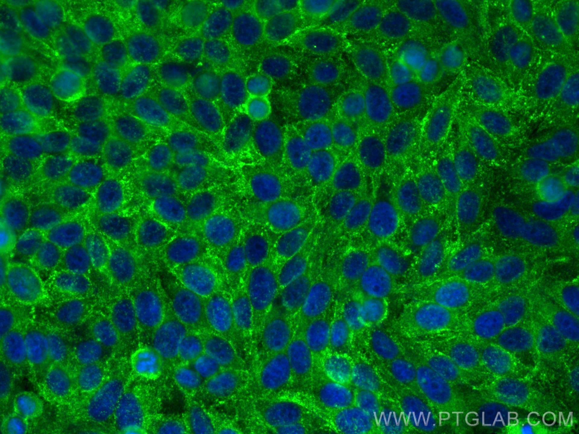 IF Staining of HepG2 using 10260-1-AP