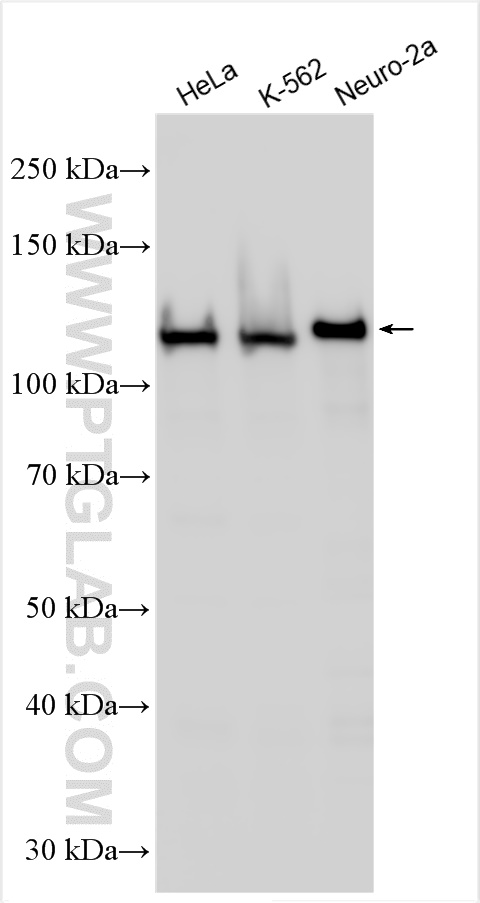 WB analysis using 10260-1-AP