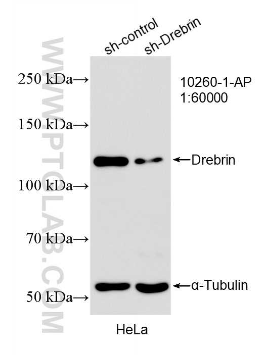 WB analysis of HeLa using 10260-1-AP