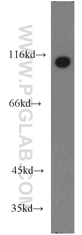 WB analysis of HeLa using 10260-1-AP