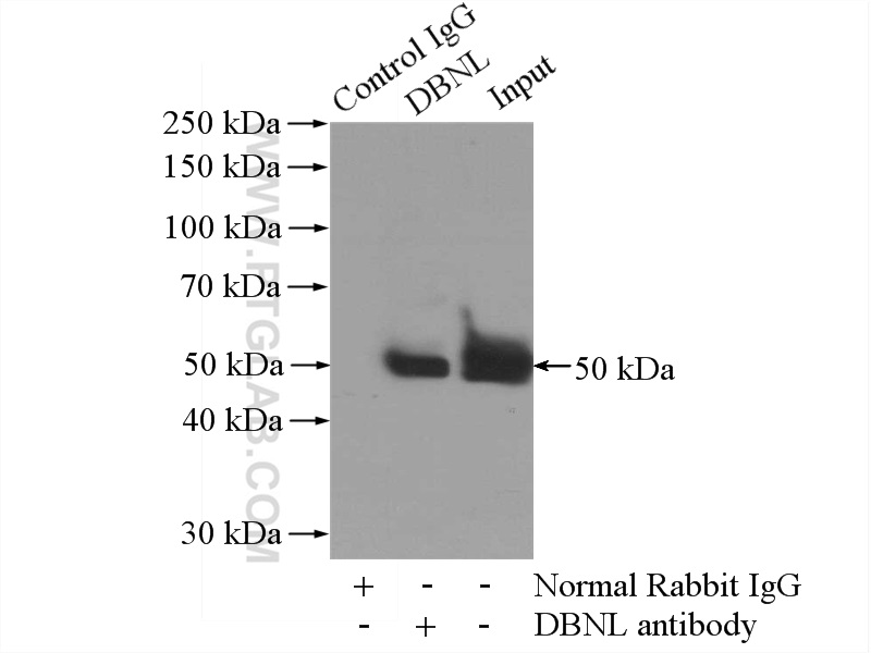 IP experiment of mouse brain using 13015-1-AP