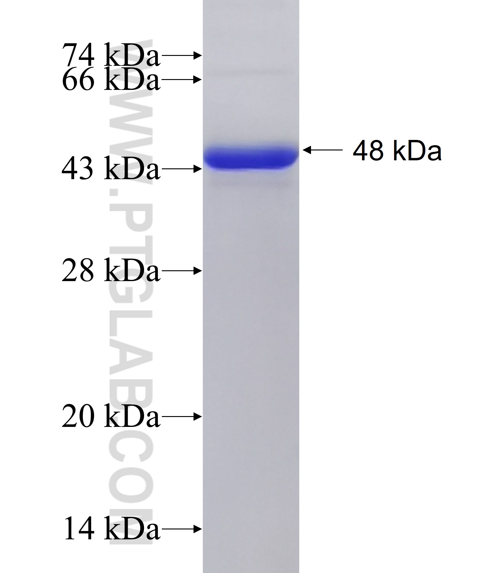 DBP fusion protein Ag14692 SDS-PAGE