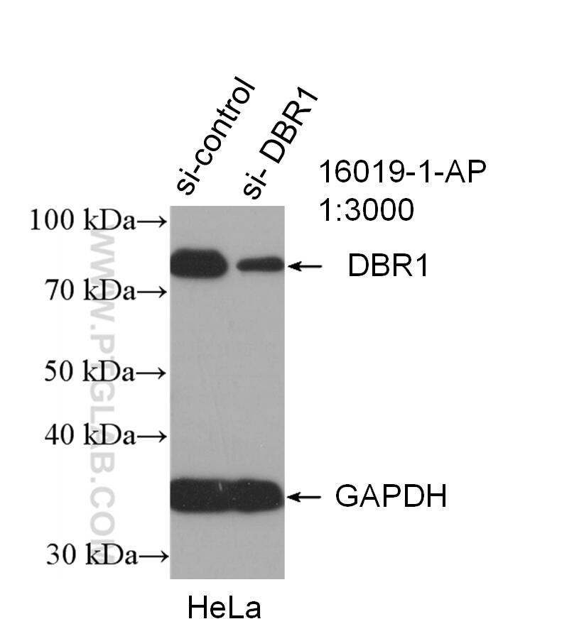 WB analysis of HeLa using 16019-1-AP