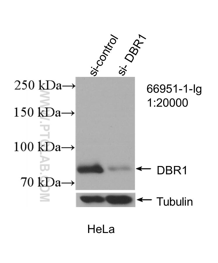 WB analysis of HeLa using 66951-1-Ig