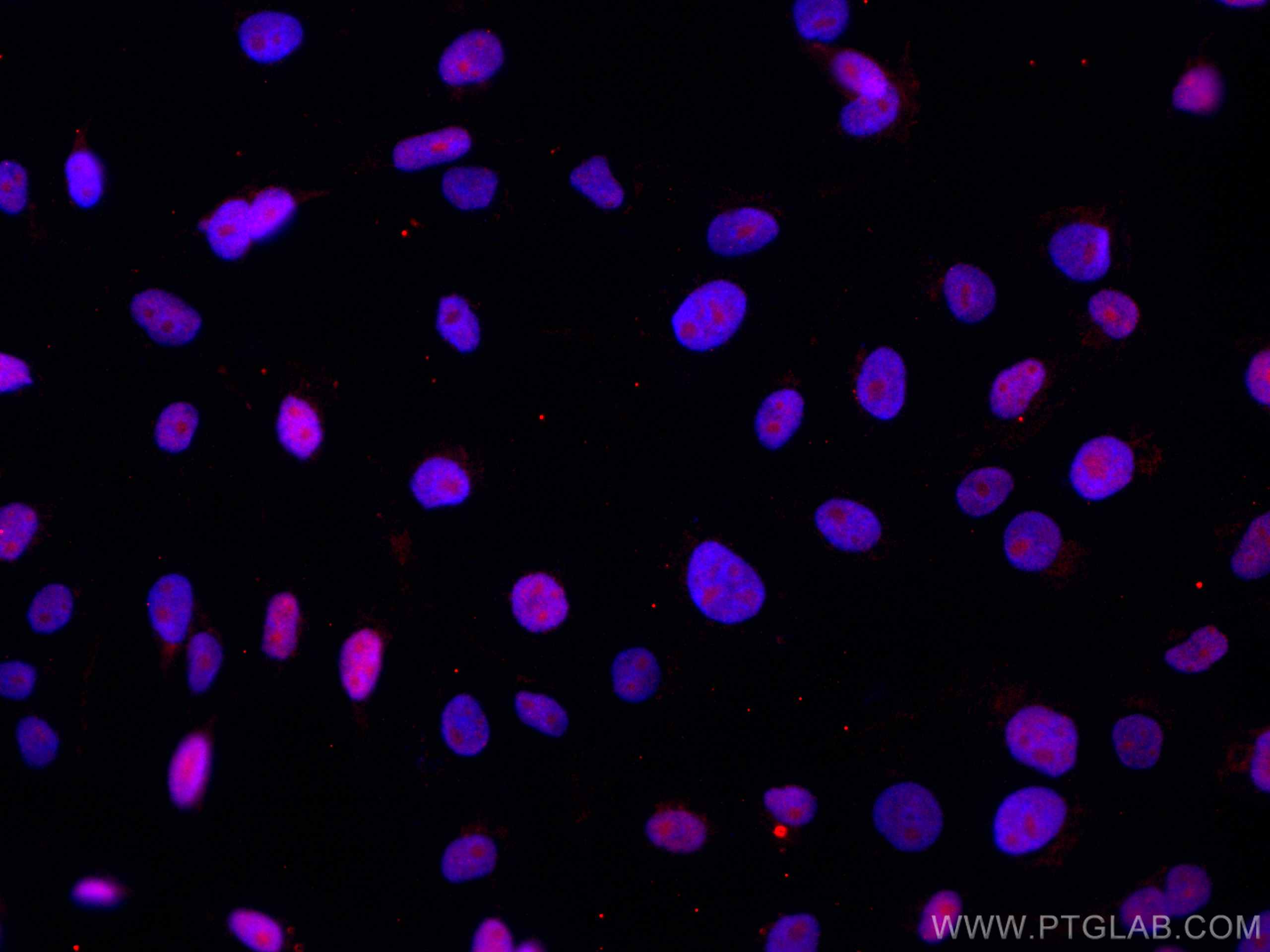 IF Staining of A431 using CL594-66951