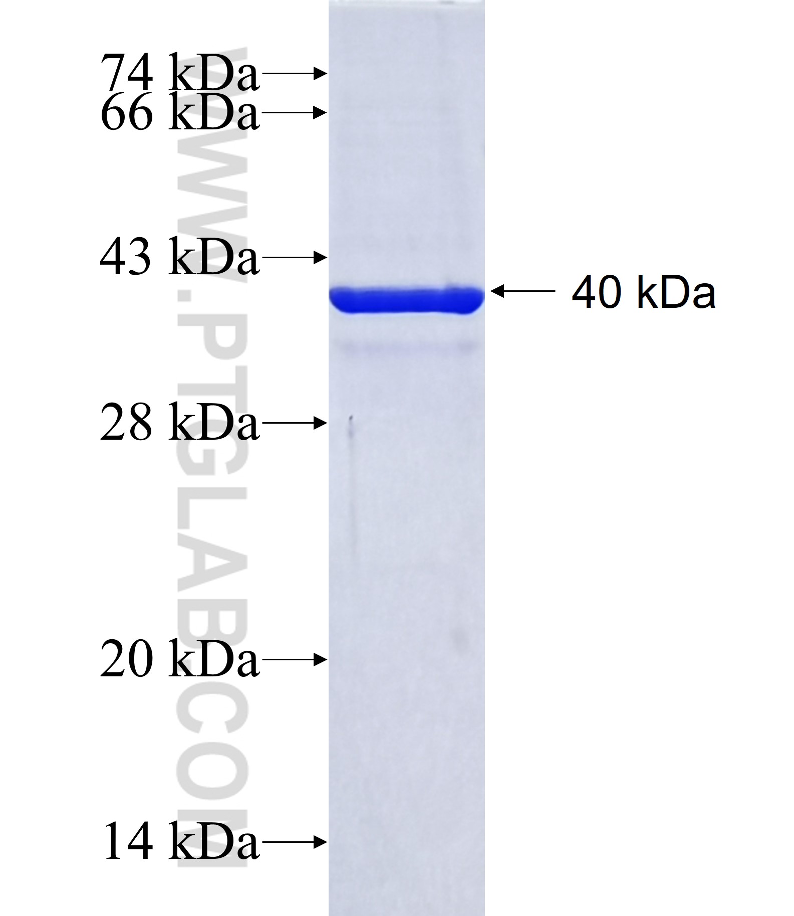 DBX1 fusion protein Ag40954 SDS-PAGE DBX1 fusion protein Ag40954 SDS-PAGE