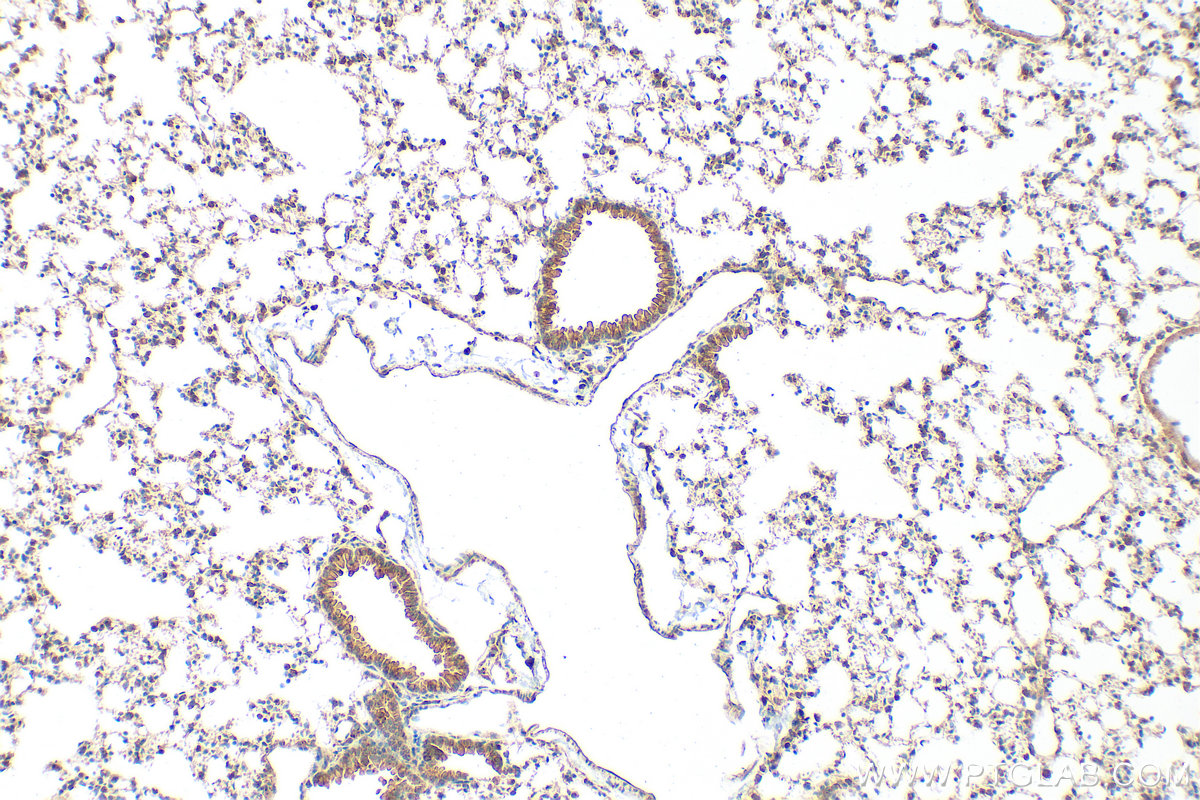 Immunohistochemical analysis of paraffin-embedded mouse lung tissue slide using 24504-1-AP (DCBLD1 antibody) at dilution of 1:1000 (under 10x lens). Heat mediated antigen retrieval with Tris-EDTA buffer (pH 9.0). IHC staining of mouse lung using 24504-1-AP