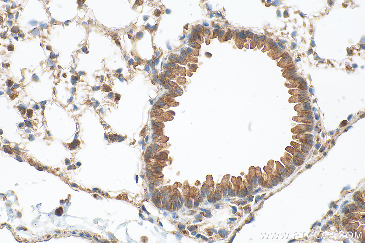 Immunohistochemical analysis of paraffin-embedded mouse lung tissue slide using 24504-1-AP (DCBLD1 antibody) at dilution of 1:1000 (under 40x lens). Heat mediated antigen retrieval with Tris-EDTA buffer (pH 9.0). IHC staining of mouse lung using 24504-1-AP