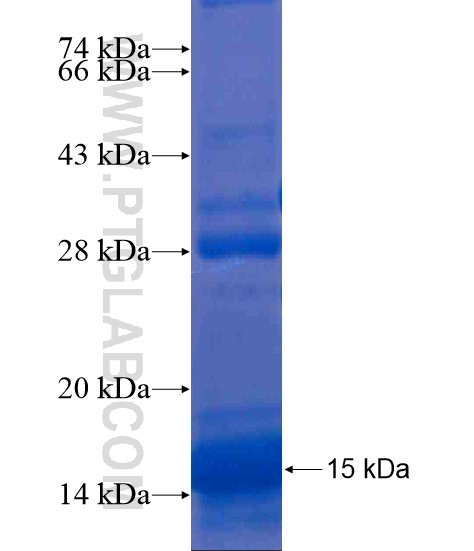 DCBLD1 fusion protein Ag21352 SDS-PAGE