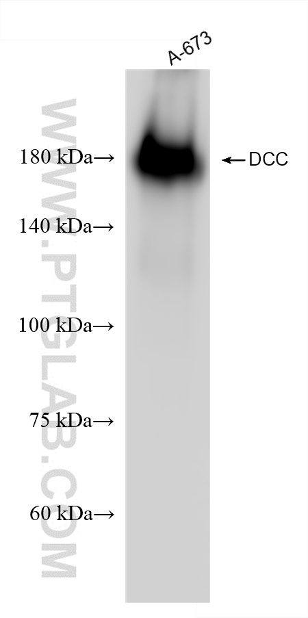WB analysis of A-673 using 85787-4-RR (same clone as 85787-4-PBS)