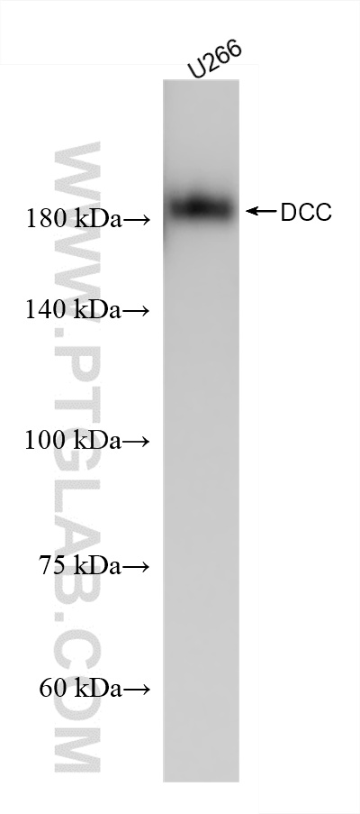 WB analysis of U266 using 85787-4-RR (same clone as 85787-4-PBS)
