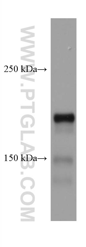 WB analysis of mouse brain using 67203-1-Ig