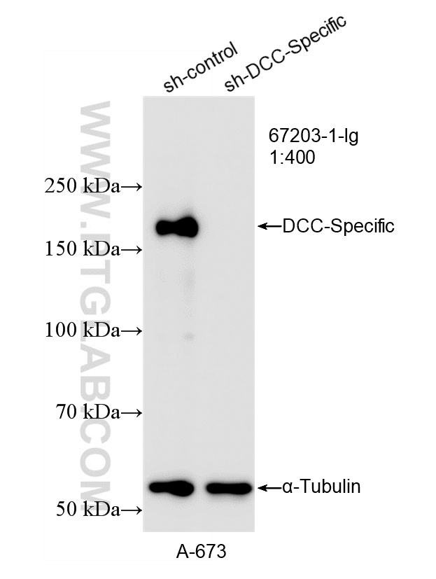 WB analysis of A-673 using 67203-1-Ig