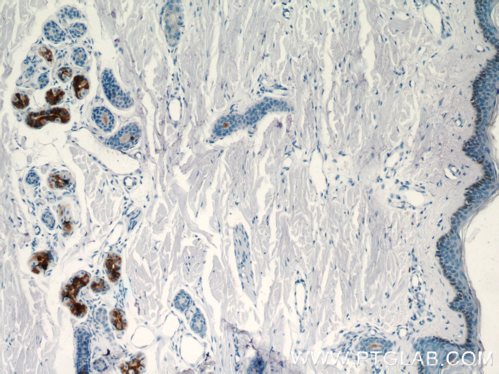 IHC staining of human skin using 11985-1-AP