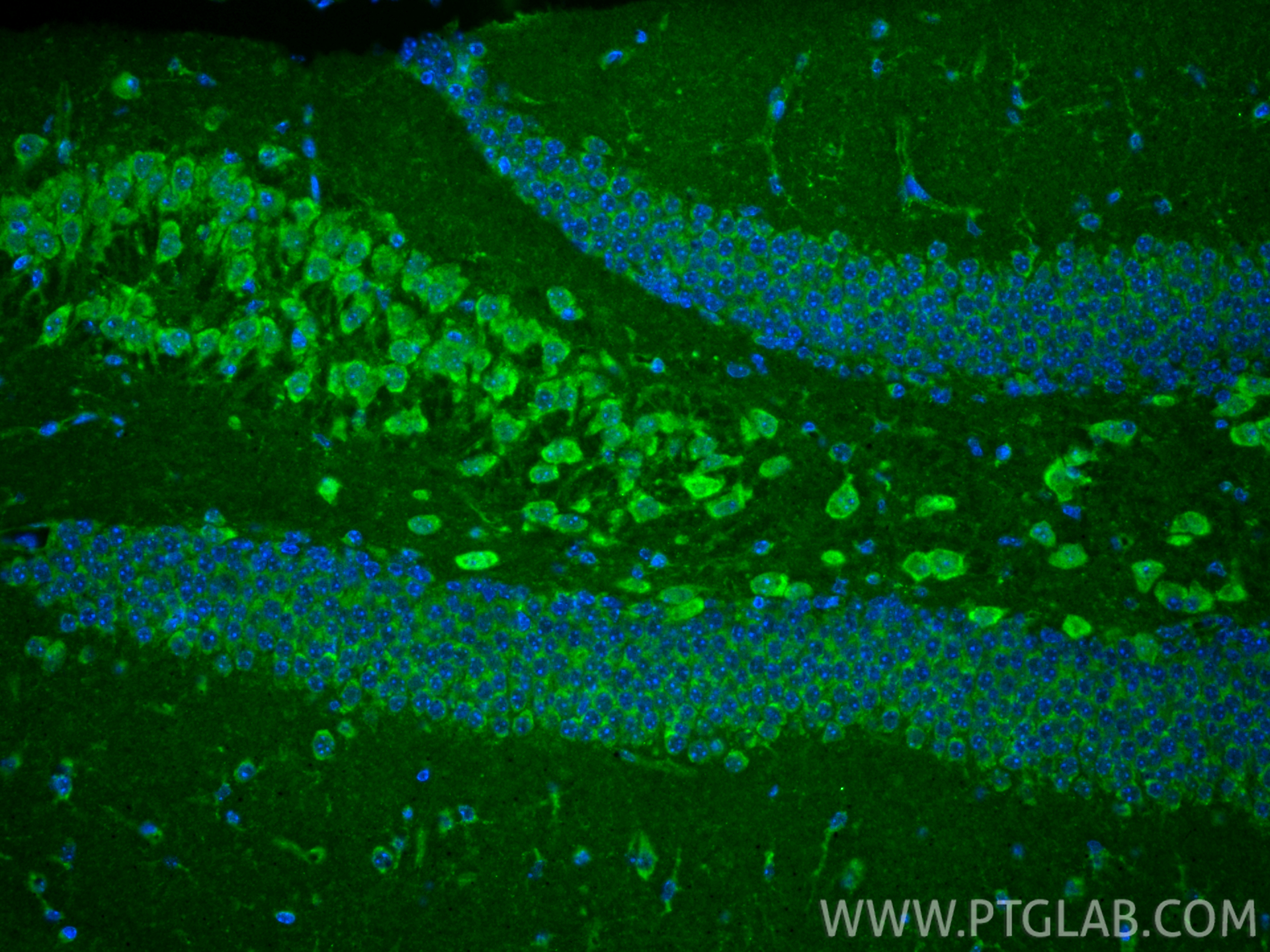 Immunofluorescent analysis of (4% PFA) fixed paraffin-embedded mouse brain tissue using DCHS1 antibody (28144-1-AP) at dilution of 1:200 and CoraLite®488-Conjugated Goat Anti-Rabbit IgG(H+L) (<a class='green' href='/productredirect?CatalogNo=SA00013-2' target='_blank'>SA00013-2</a>). Heat mediated antigen retrieval with Tris-EDTA buffer (pH 9.0). IF Staining of mouse brain using 28144-1-AP