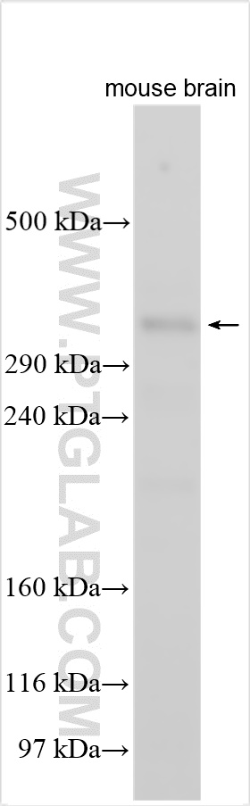 WB analysis using 28144-1-AP