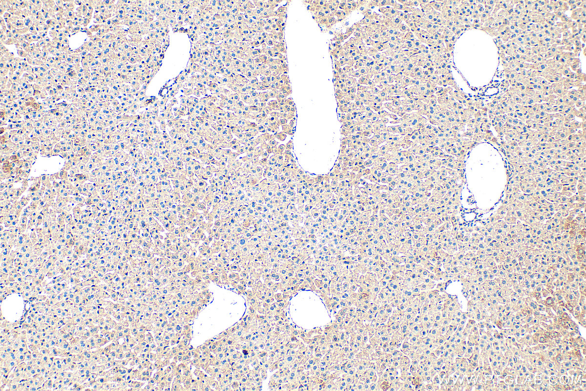 IHC staining of mouse liver using 11535-1-AP