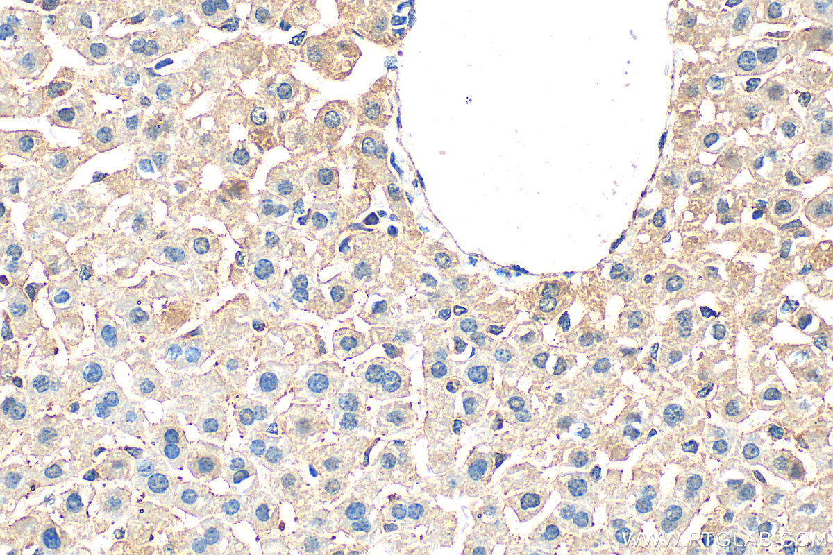 IHC staining of mouse liver using 11535-1-AP