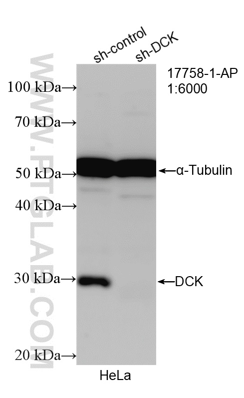 WB analysis of HeLa using 17758-1-AP WB analysis of HeLa using 17758-1-AP