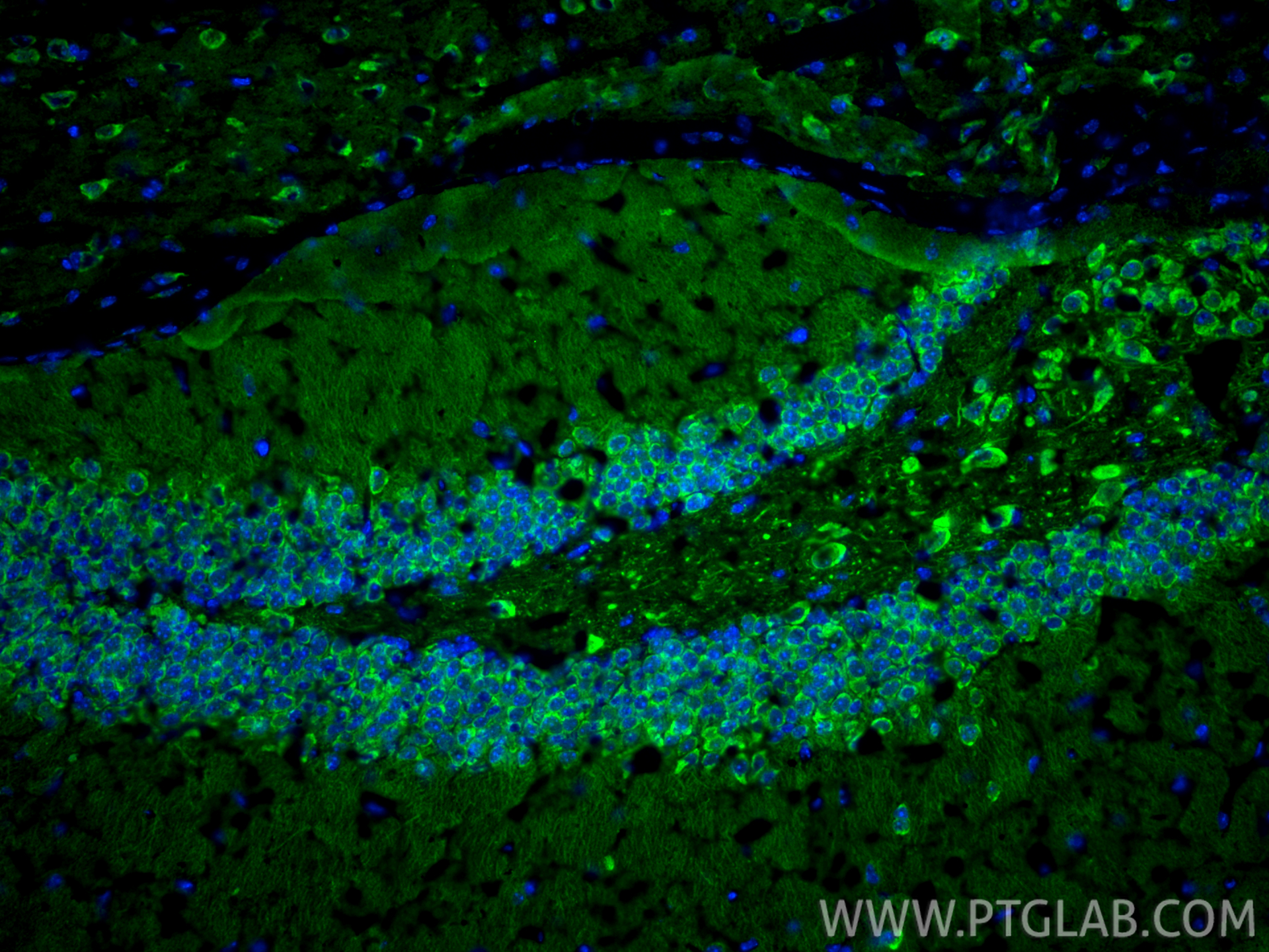Immunofluorescent analysis of (4% PFA) fixed frozen OCT-embedded mouse brain tissue using DCLK1 antibody (21699-1-AP) at dilution of 1:200 and CoraLite®488-Conjugated Goat Anti-Rabbit IgG(H+L) (<a class='green' href='/productredirect?CatalogNo=SA00013-2' target='_blank'>SA00013-2</a>). IF Staining of mouse brain using 21699-1-AP