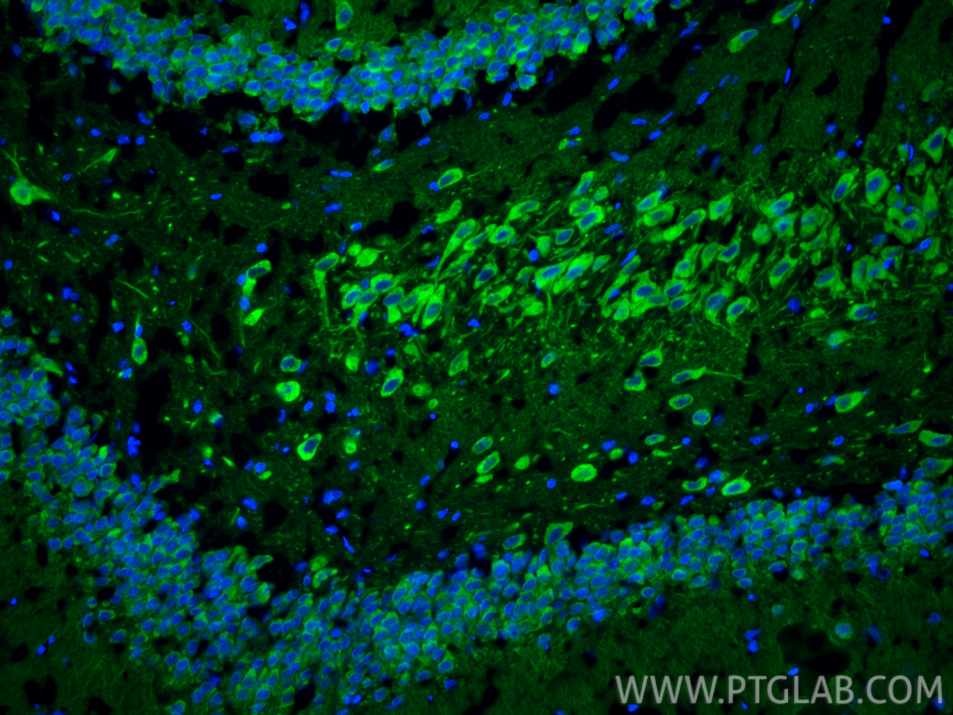 Immunofluorescent analysis of (4% PFA) fixed frozen OCT-embedded rat brain tissue using DCLK1 antibody (21699-1-AP) at dilution of 1:200 and CoraLite®488-Conjugated Goat Anti-Rabbit IgG(H+L) (<a class='green' href='/productredirect?CatalogNo=SA00013-2' target='_blank'>SA00013-2</a>). IF Staining of rat brain using 21699-1-AP