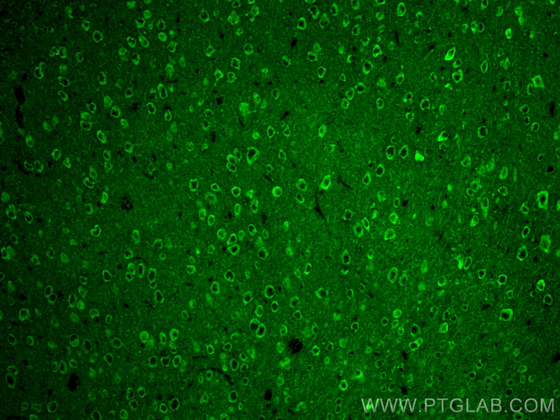IF Staining of mouse brain using 29800-1-AP