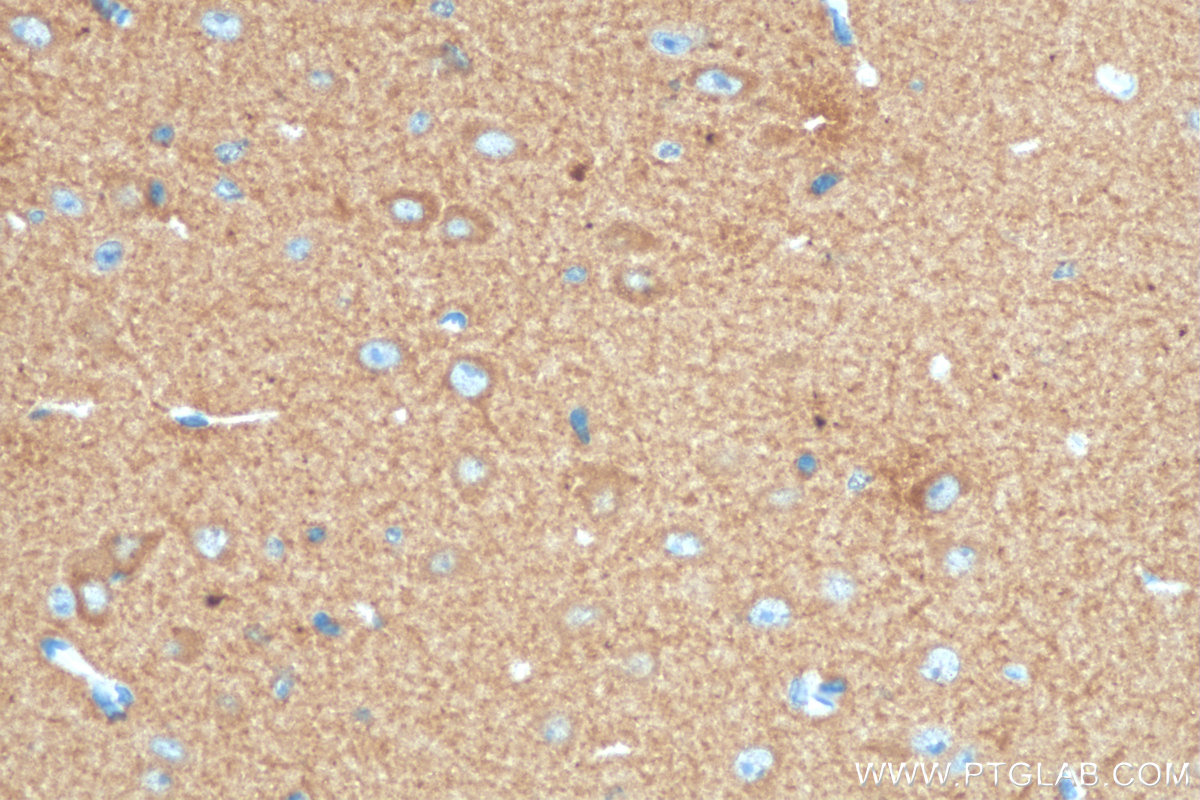 IHC staining of mouse brain using 68234-1-Ig