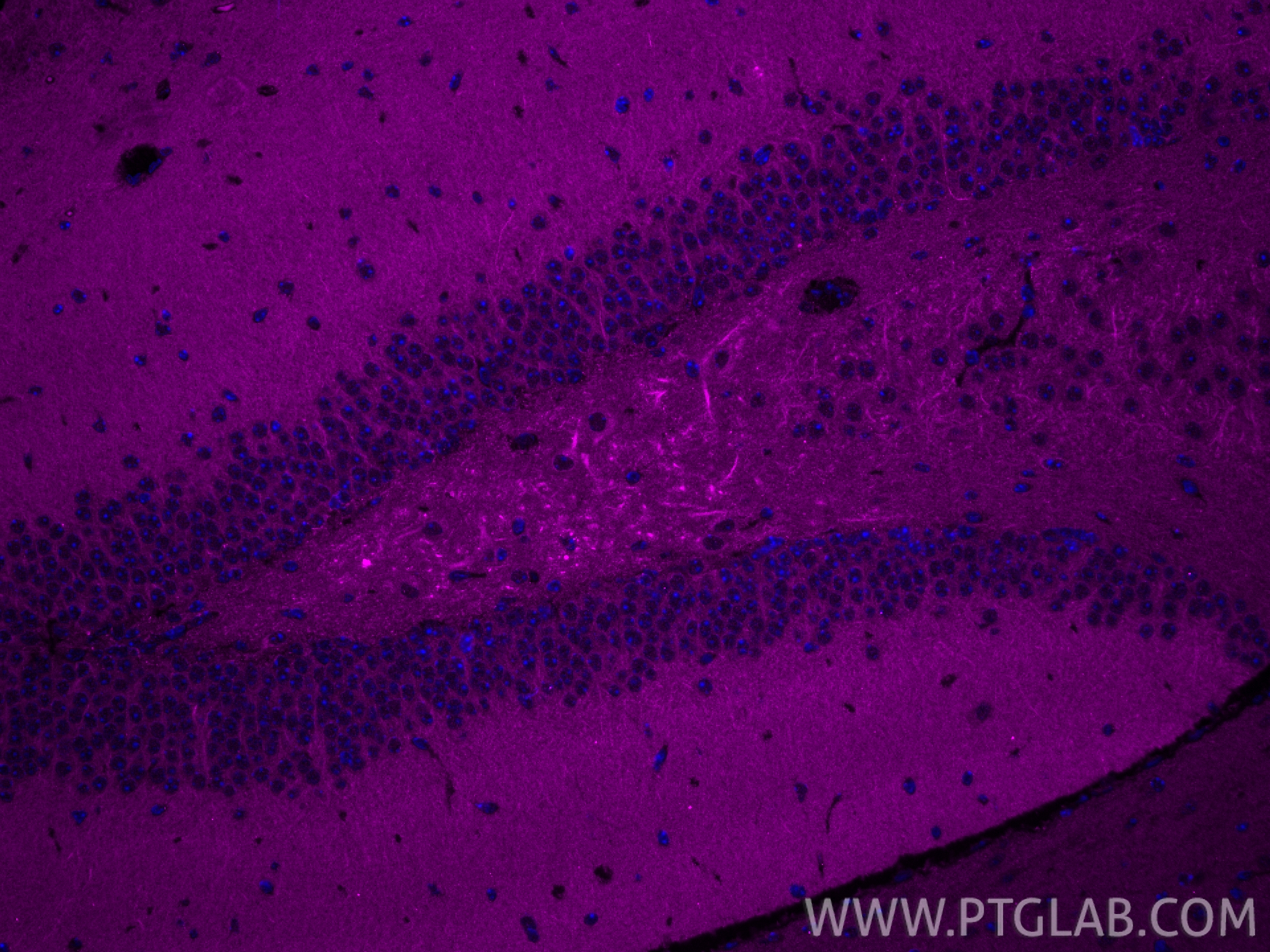 IF Staining of mouse brain using CL647-68234 IF Staining of mouse brain using CL647-68234