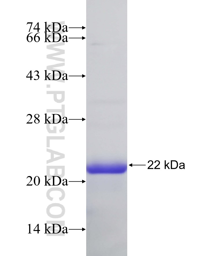DCLK1 fusion protein Ag32019 SDS-PAGE