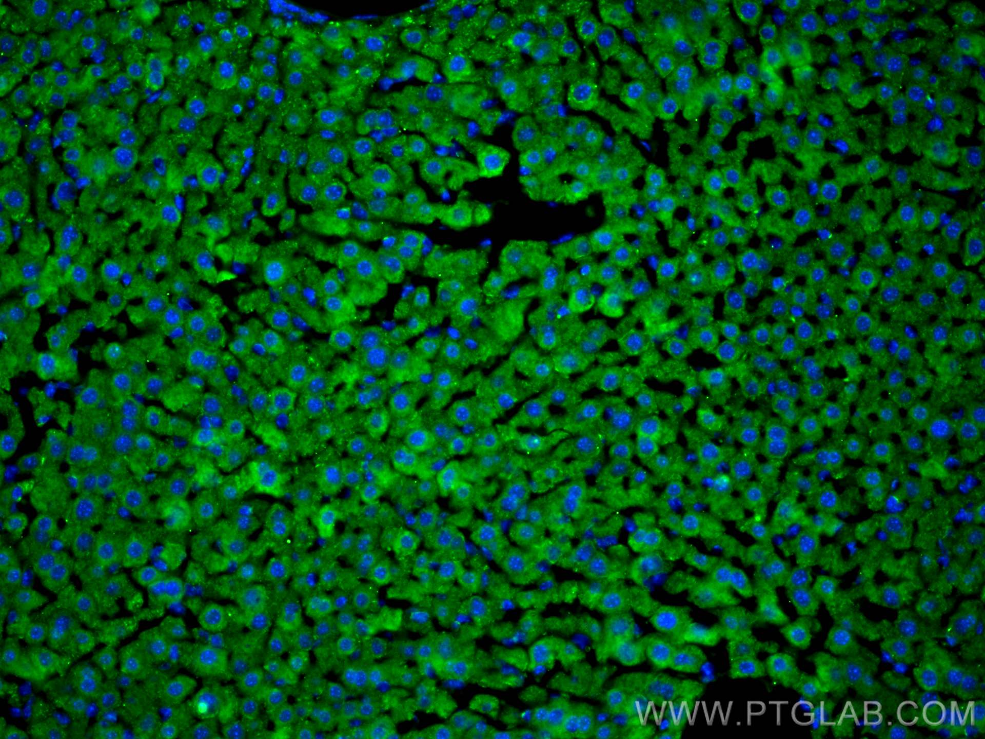 IF Staining of mouse liver using 14667-1-AP
