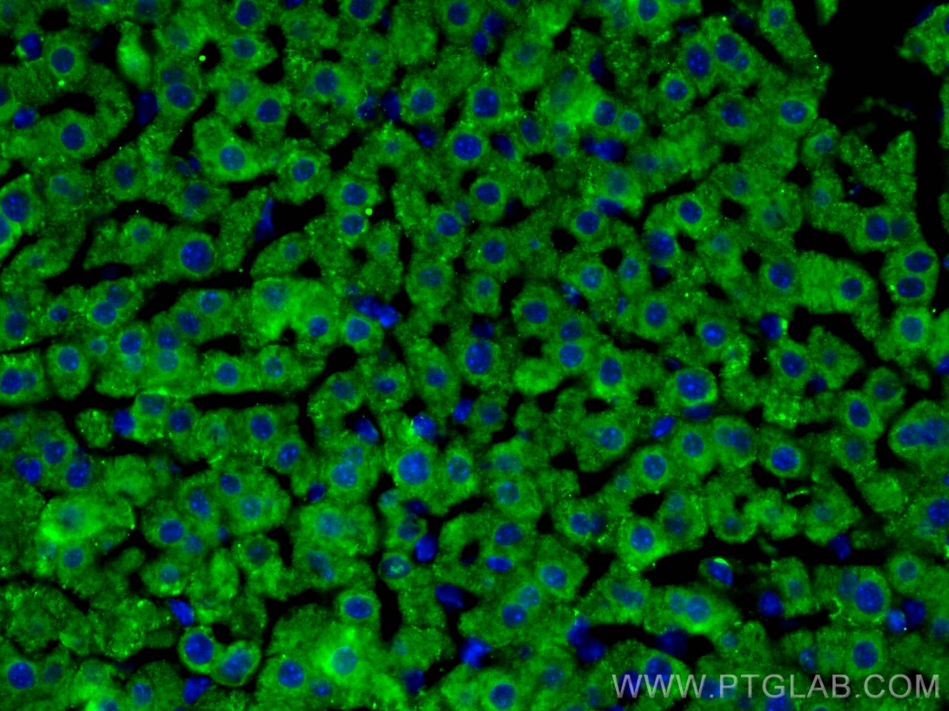 IF Staining of mouse liver using 14667-1-AP