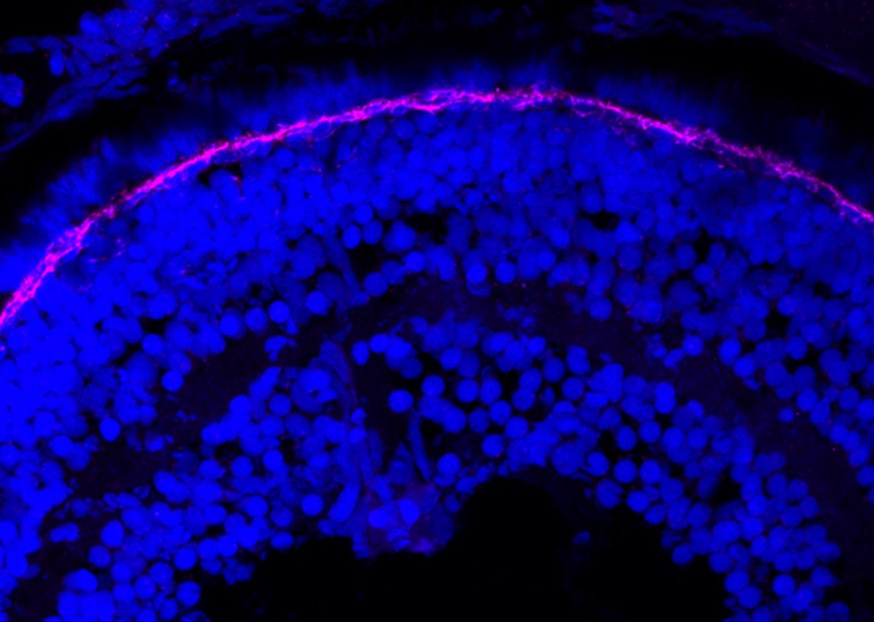 IF Staining of zebrafish retina using 14667-1-AP