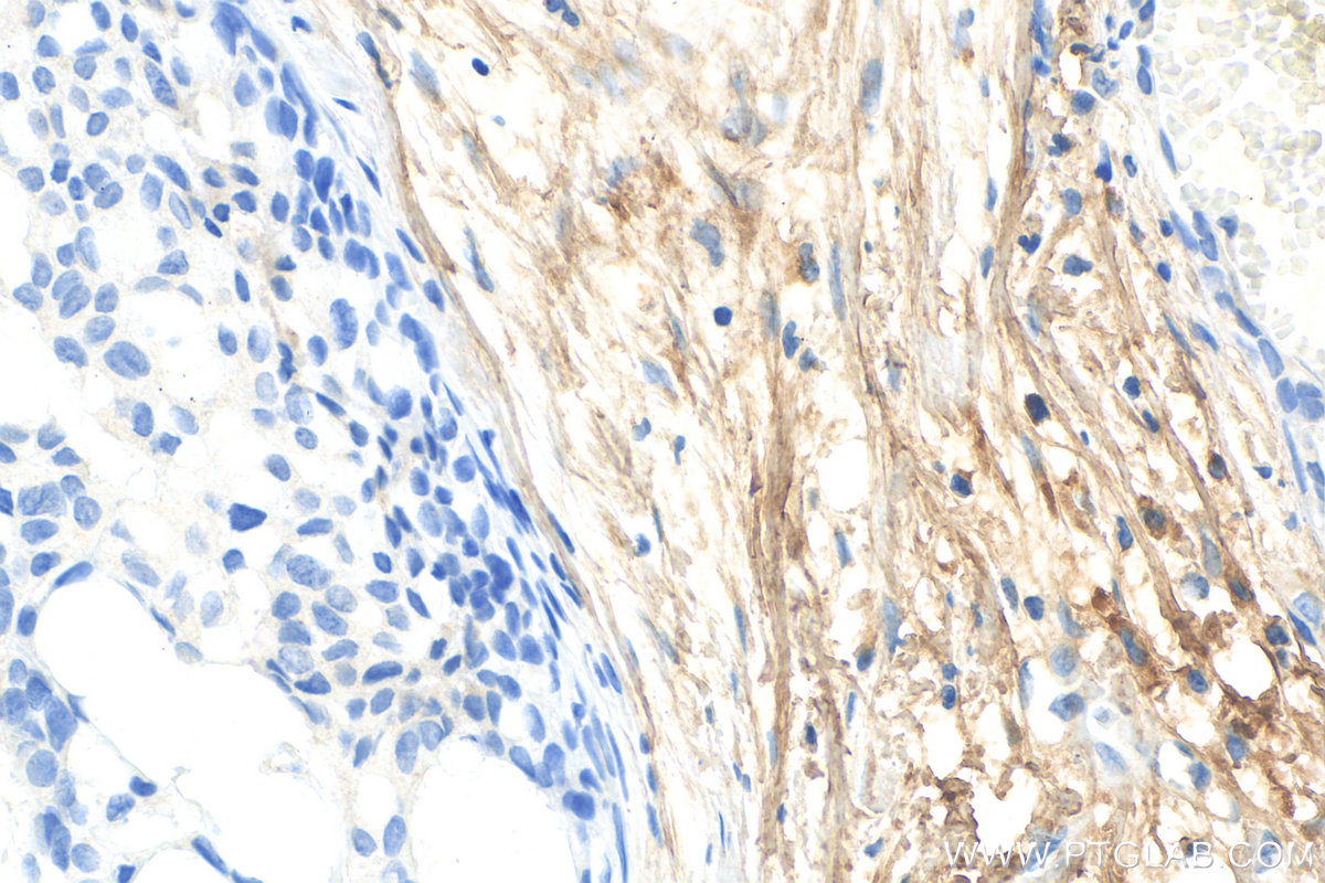 IHC staining of human breast hyperplasia using 14667-1-AP