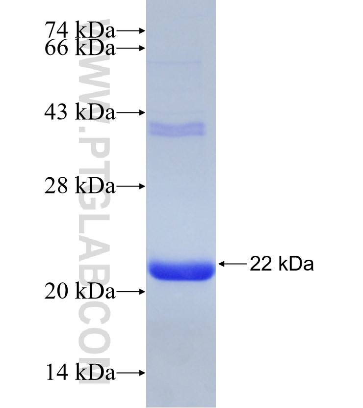 DCN fusion protein Ag30859 SDS-PAGE DCN fusion protein Ag30859 SDS-PAGE
