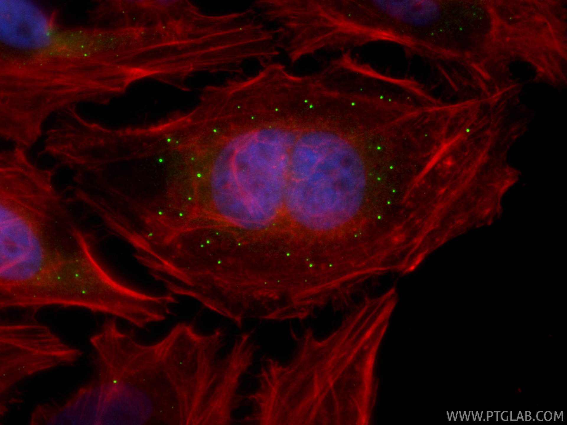 IF Staining of HeLa using 22373-1-AP IF Staining of HeLa using 22373-1-AP