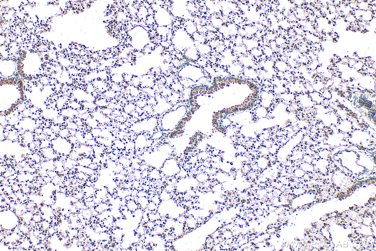 Immunohistochemical analysis of paraffin-embedded mouse lung tissue slide using 22373-1-AP (DCP1A antibody) at dilution of 1:200 (under 10x lens). Heat mediated antigen retrieval with Tris-EDTA buffer (pH 9.0). IHC staining of mouse lung using 22373-1-AP