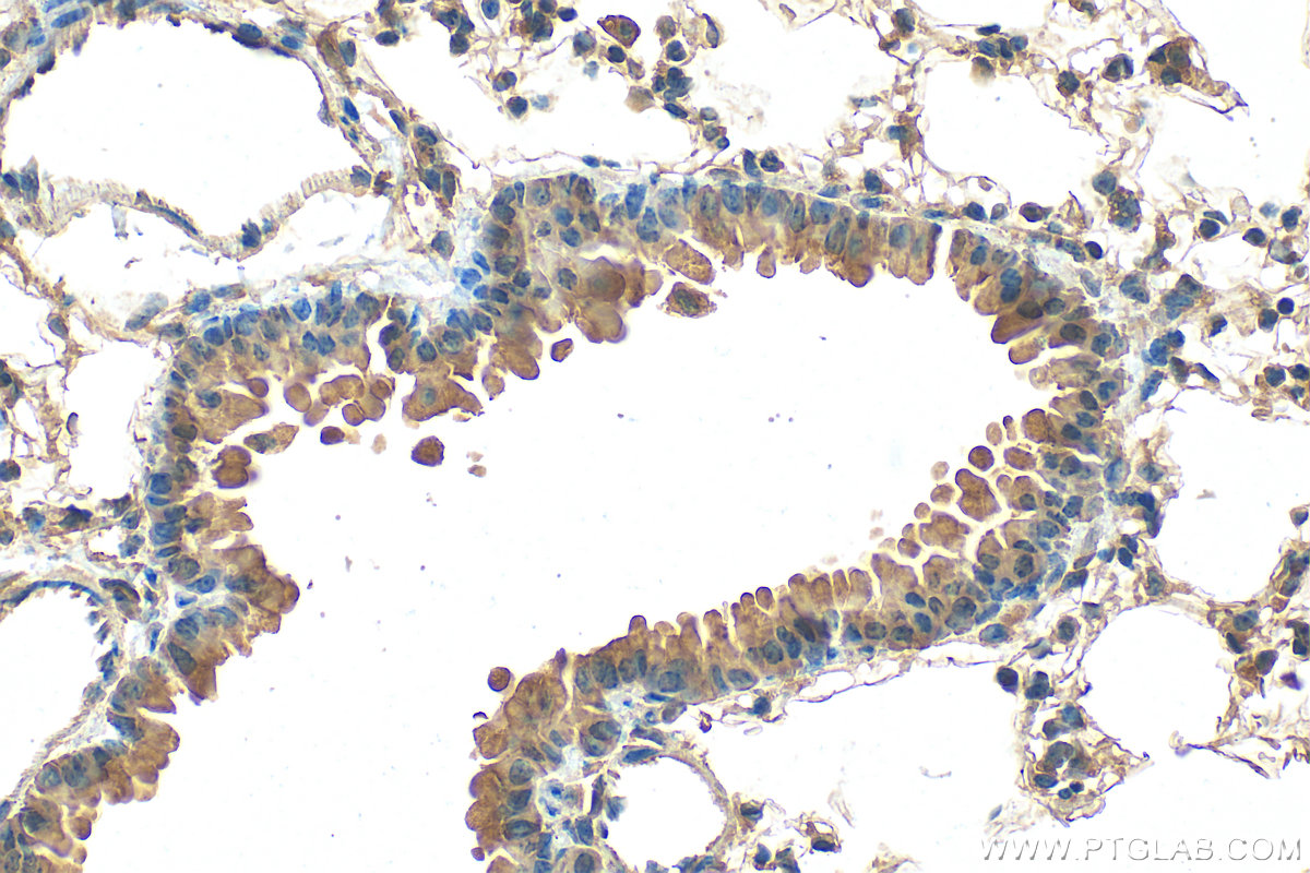 Immunohistochemical analysis of paraffin-embedded mouse lung tissue slide using 22373-1-AP (DCP1A antibody) at dilution of 1:200 (under 40x lens). Heat mediated antigen retrieval with Tris-EDTA buffer (pH 9.0). IHC staining of mouse lung using 22373-1-AP