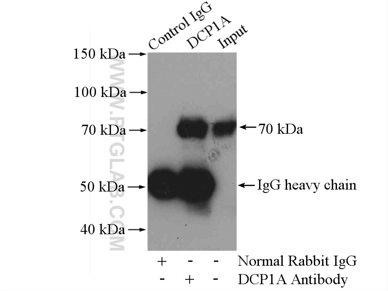 IP experiment of mouse brain using 22373-1-AP