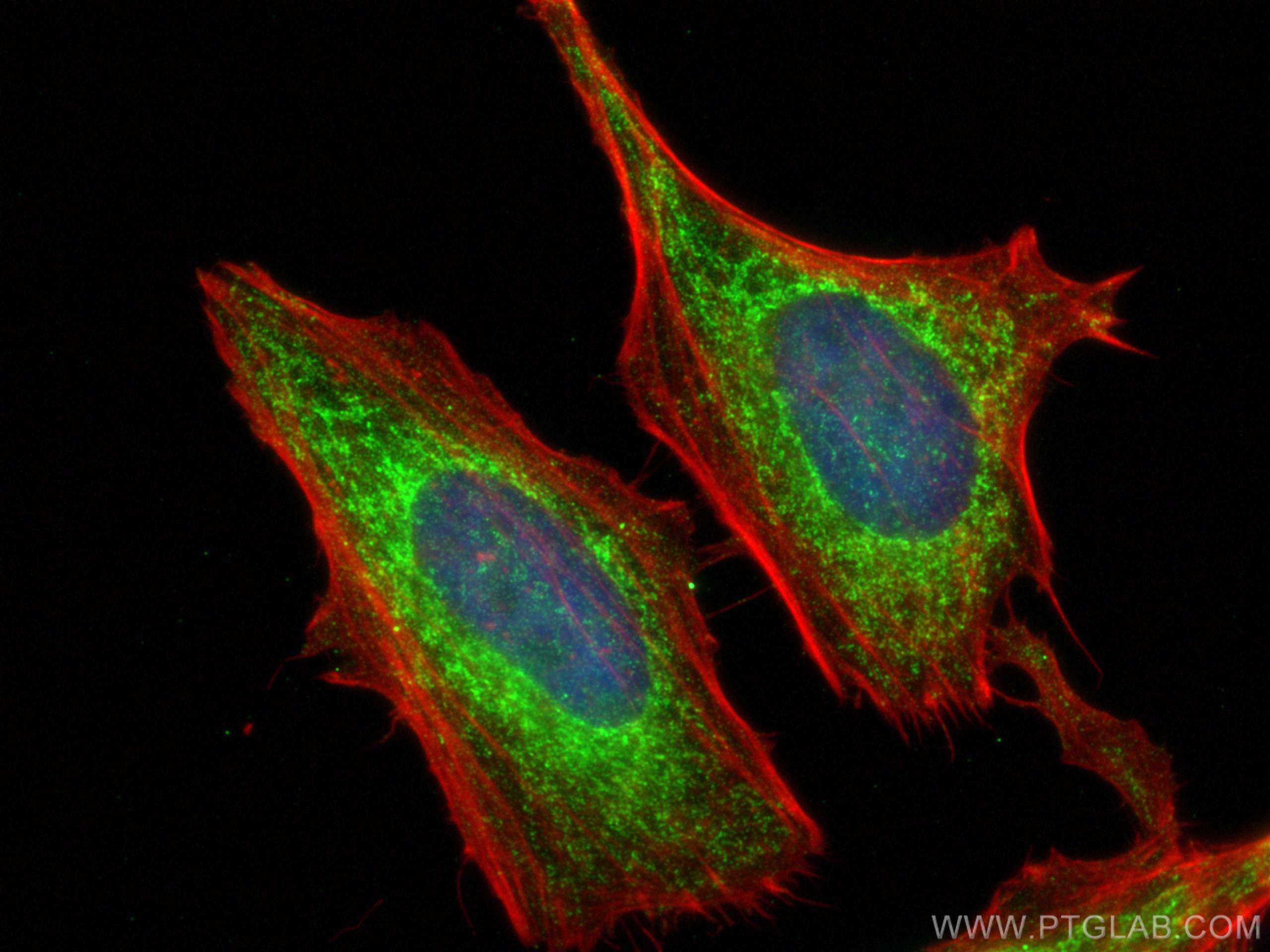 IF Staining of HeLa using 13863-1-AP