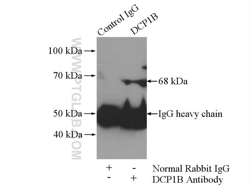 IP experiment of HeLa using 13863-1-AP