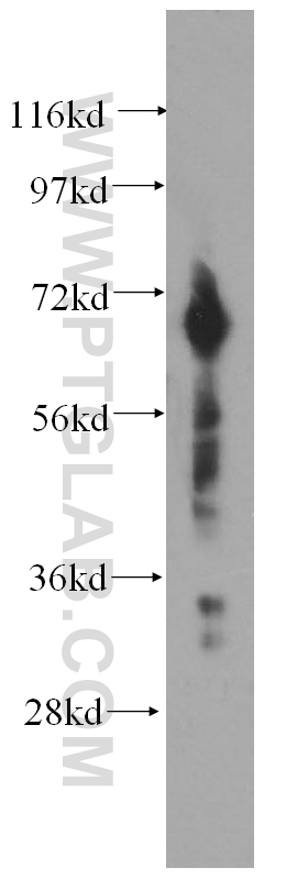 DCP1B