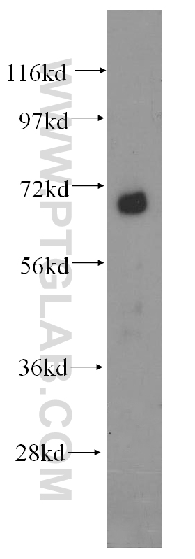 DCP1B Polyclonal antibody