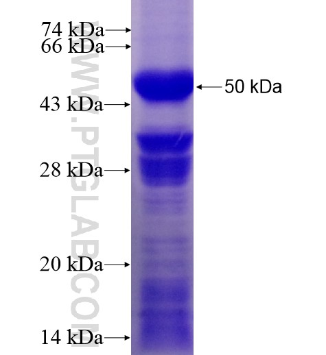 DCP2 fusion protein Ag12727 SDS-PAGE DCP2 fusion protein Ag12727 SDS-PAGE