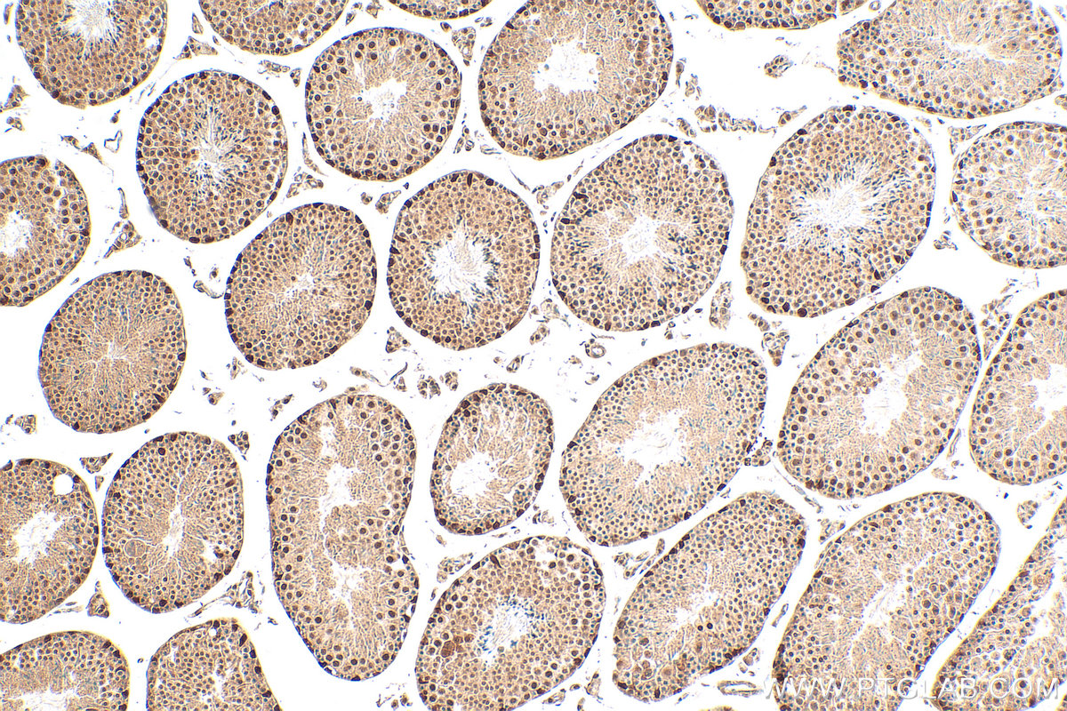 IHC staining of mouse testis using 28465-1-AP