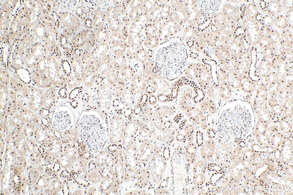IHC staining of human kidney using 28465-1-AP